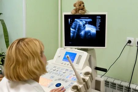 广州医学院第三附属医院引进超声自动乳腺全容积成像系统