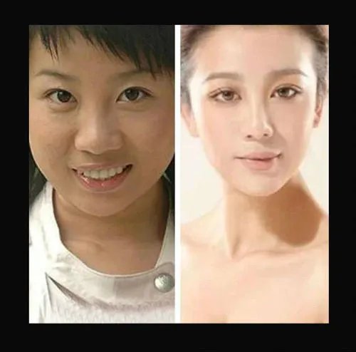 张冬玲整容前后对比照 张冬玲的老公是阿宝吗