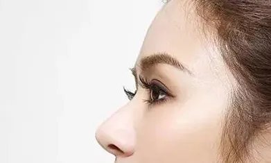 软骨隆鼻术多少钱