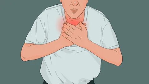 肺炎种类有哪些