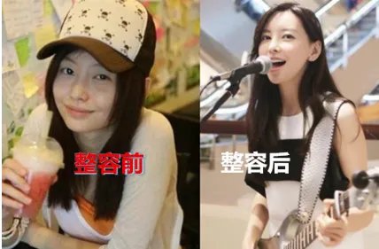 于文文整容前照片被扒是什么样子的？