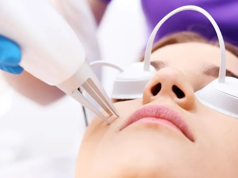 如何消除面部红血丝