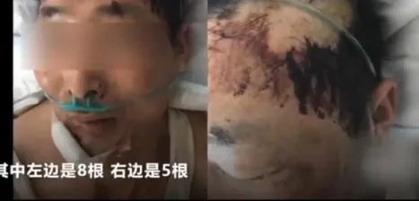 制止小孩乱跑遭打是怎么回事?