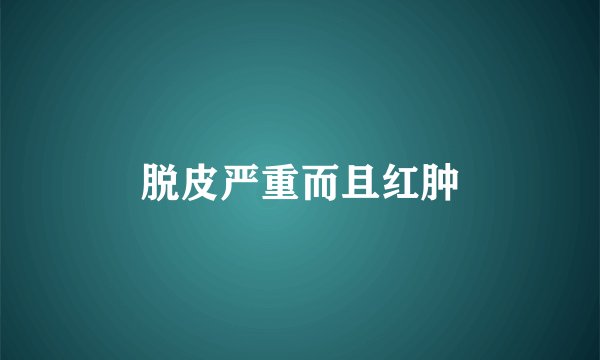 脱皮严重而且红肿