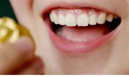 种植牙齿多少钱	