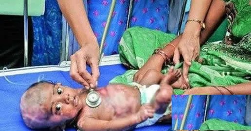 三月男婴身体无故自燃医生无解（图）