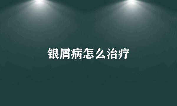 银屑病怎么治疗