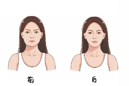 瘦脸针效果对比图