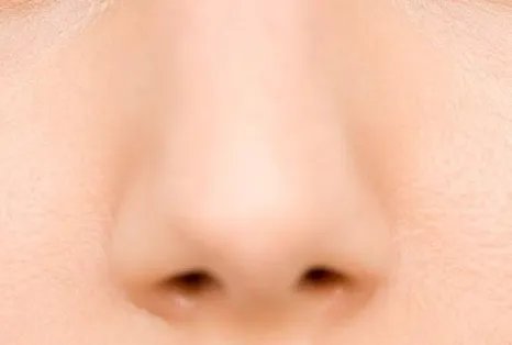 鼻翼整形术后如何护理