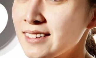 果酸嫩肤的优势