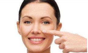 法令纹去除好不好