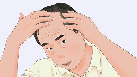 男人秃头原因有什么