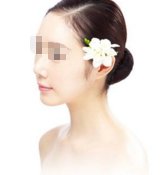 光子嫩肤效果怎么样