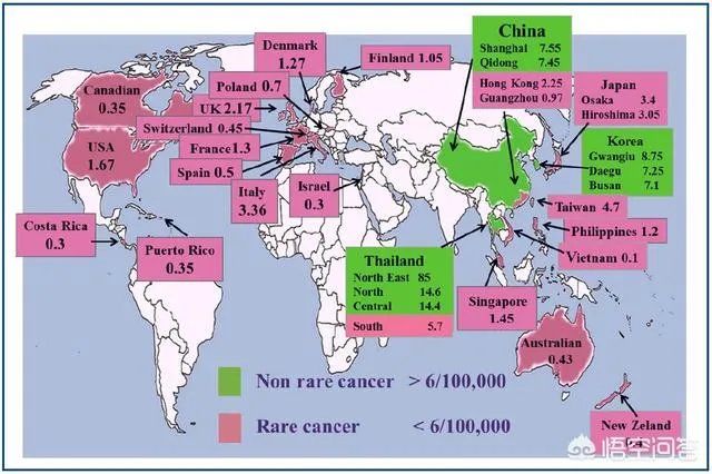 《金粉世家》的导演李大为因罹患胆管细胞癌去世，这种癌症很难治吗？