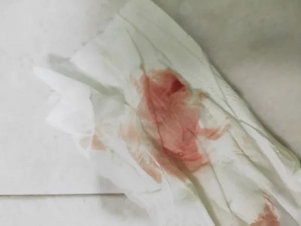 着床成功后出血是什么样子的，有图片吗？