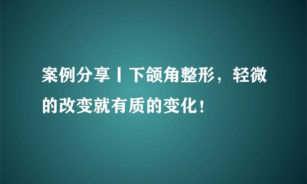 案例分享丨下颌角整形，轻微的改变就有质的变化！