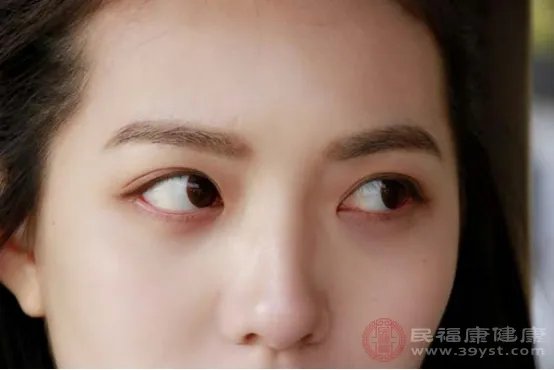 眼睛有红血丝是怎么回事