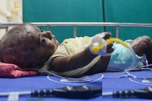 三月男婴身体无故自燃医生无解（图）