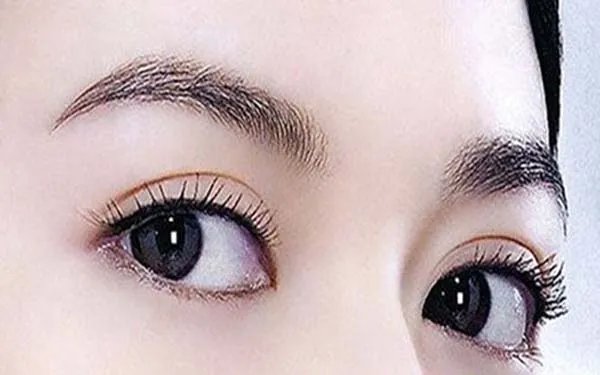 上海哪几家整形医院双眼皮做的好