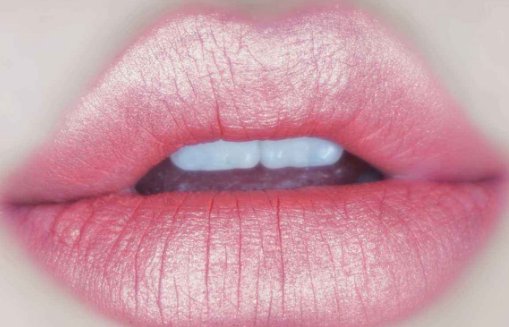 玻尿酸丰唇多少钱