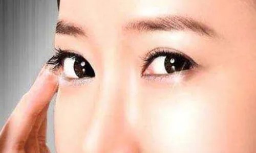 激光祛眼袋的过程