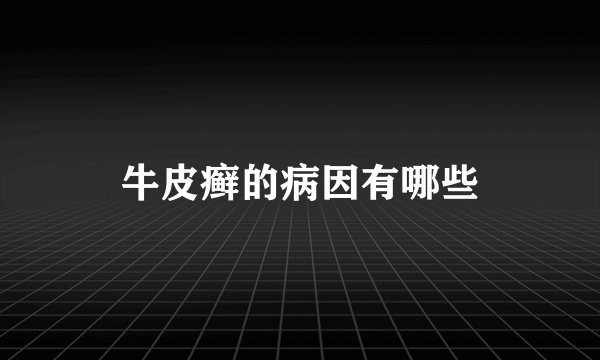 牛皮癣的病因有哪些