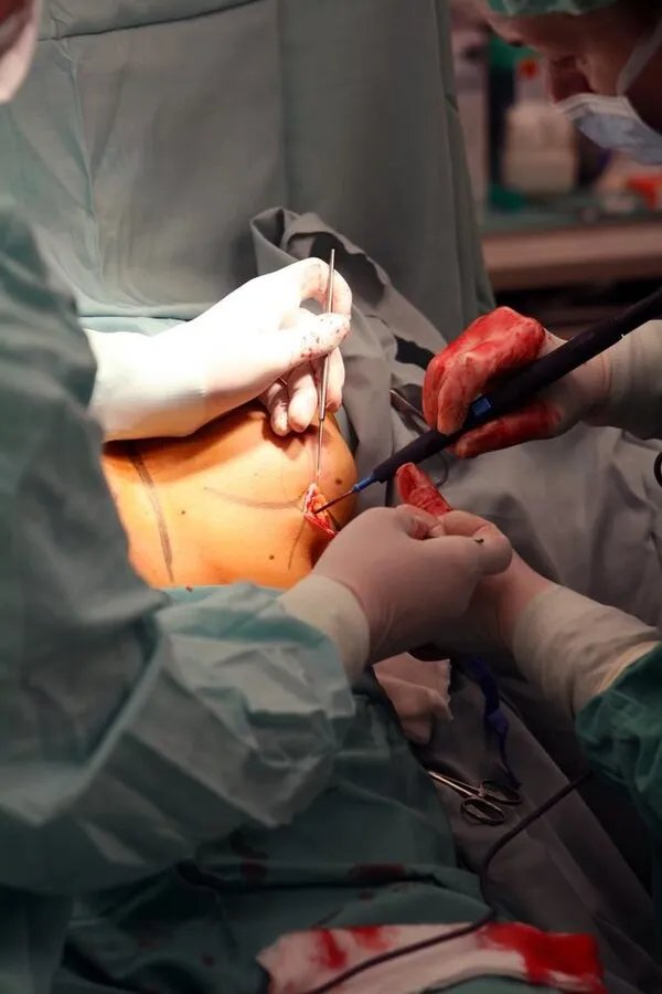 好的丰胸产品有那些